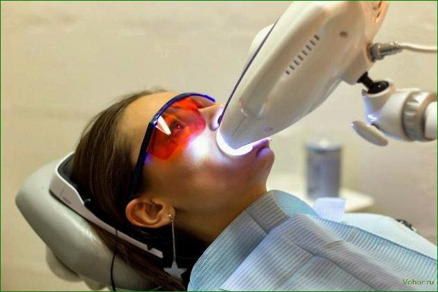 Эффективное и безопасное отбеливание зубов с помощью системы Zoom